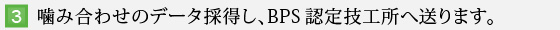 3.噛み合わせのデータ採得し、BPS認定技工所へ送る